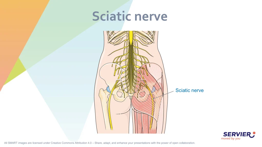 Diagrama anatômico das costas e pernas destacando o trajeto do nervo ciático, utilizado para explicar a origem da dor no Sinal de Lasègue.