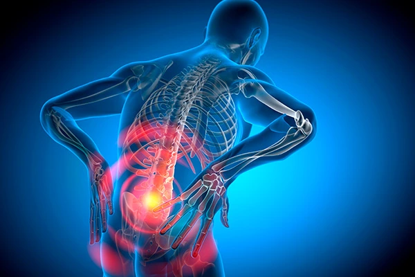 Ilustração em 3D do corpo humano em tons de azul, destacando a região lombar com círculos vermelhos e amarelos, representando a necessidade de remédios para dor na coluna.