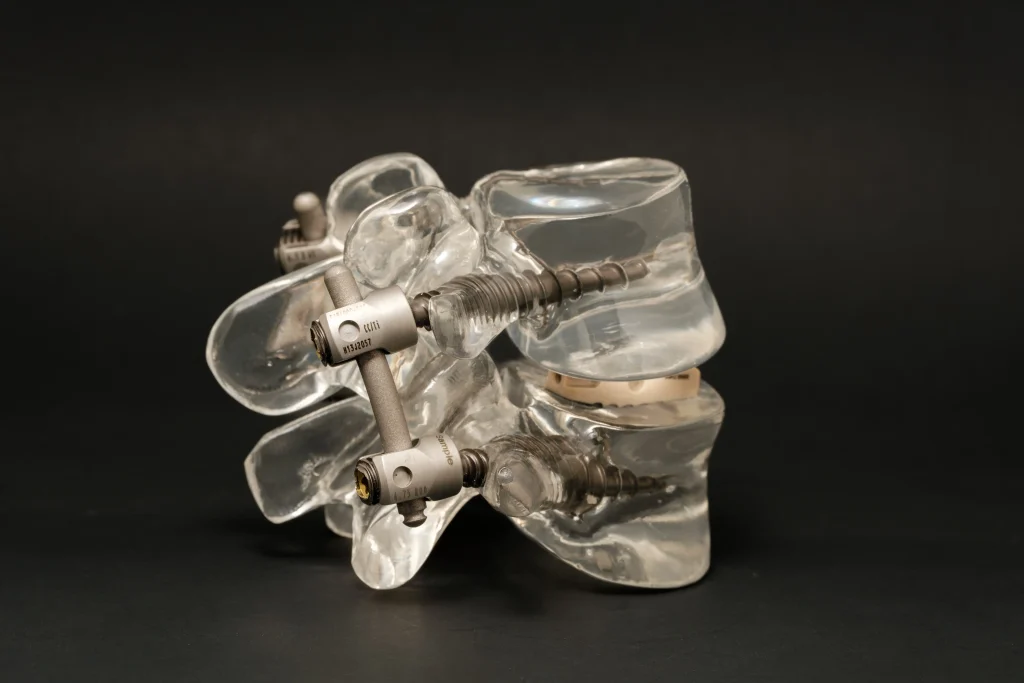 Modelo de anatomia com parafusos de artrodese da coluna visíveis entre as vértebras lombares.