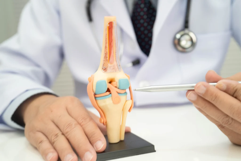 Médico apontando com uma caneta para um modelo anatômico de articulação, usado no consultório para diferenciar dores articulares daquelas causadas por desidratação discal.