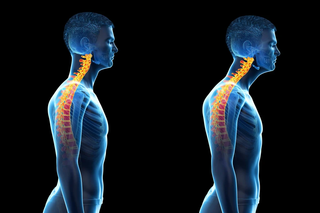 Ilustração 3D da coluna vertebral destacando a região cervical durante o processo de reeducação postural.